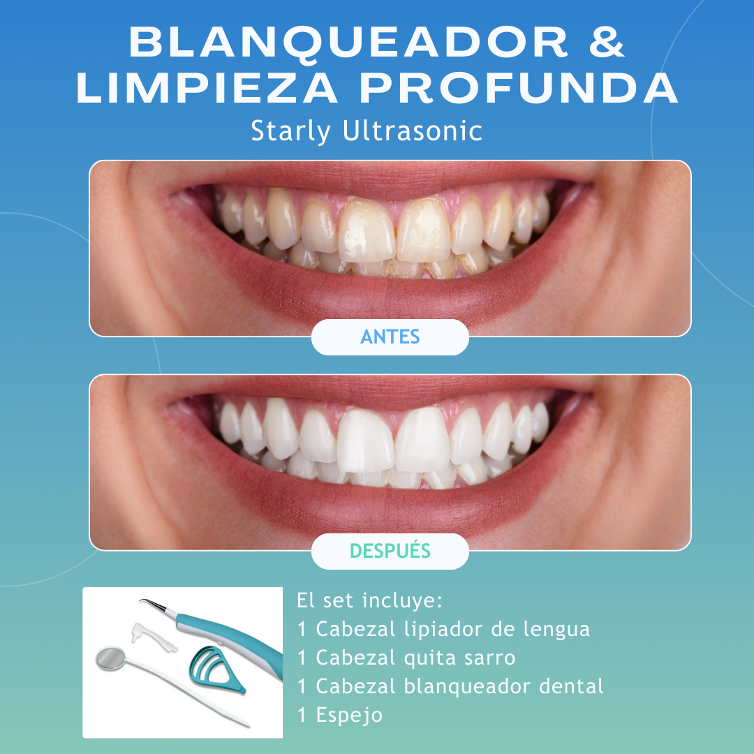Limpiador Dental con Vibración de Alta Frecuencia - Blanqueador Dental